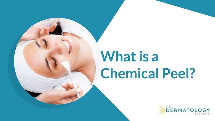 Phenol Chemical Peel Before and After